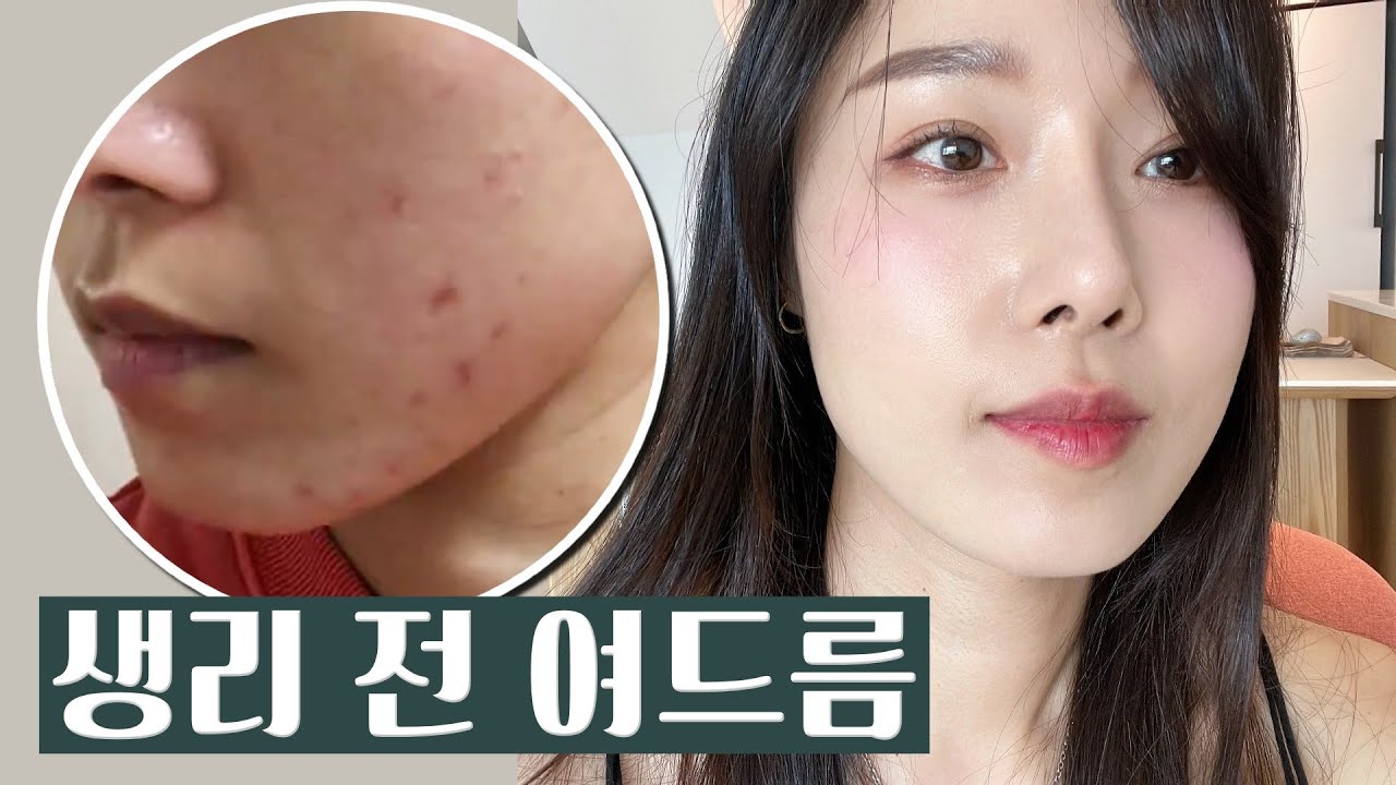 관련 이미지 1